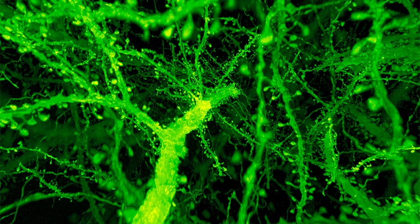 وسيلة جديدة تمكن الباحثين من مشاهدة العصبونات في أثناء إجراء الحسابات - الدماغ يشبه الحاسوب، تشغل فيه الخلايا العصبية وظيفة الدوائر الكهربائية 