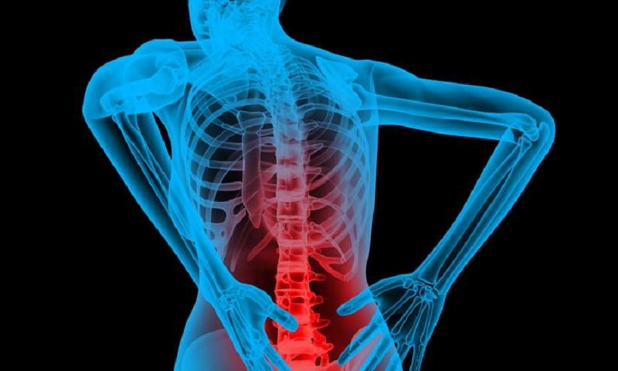 السل العظمي: الأسباب والأعراض والتشخيص والعلاج - جرثومة المفطورات السلية، وهو أحد الأمراض العشرة الأكثر تسببًا بالموت - سل العظام والمفاصل
