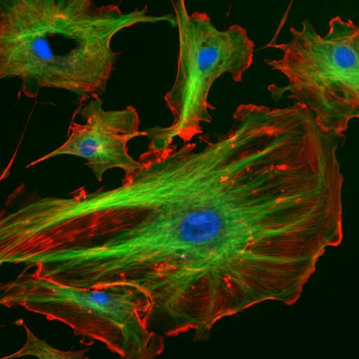 تُظهر هذه الصورة النواة باللون الأزرق، وخيوط الأكتين على محيط الخلية باللون الأحمر، وشبكة الأنبيبات الدقيقة الممتدة بالأخضر.