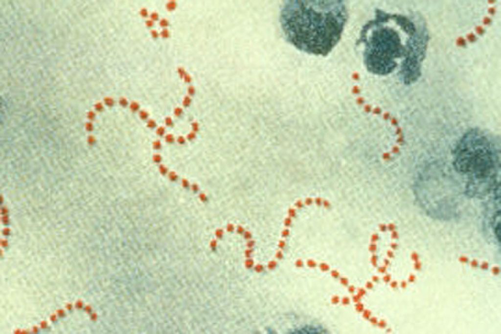 شرح الصورة: مكورات عقدية مقيحة ما هي البكتيريا ما هي الجراثيم كيف تتكاثر الخلايا البكتيرية مقاومة الجراثيم للمضادات الحيوية الحمض النووي الريبي الخلايا خيققية النواة