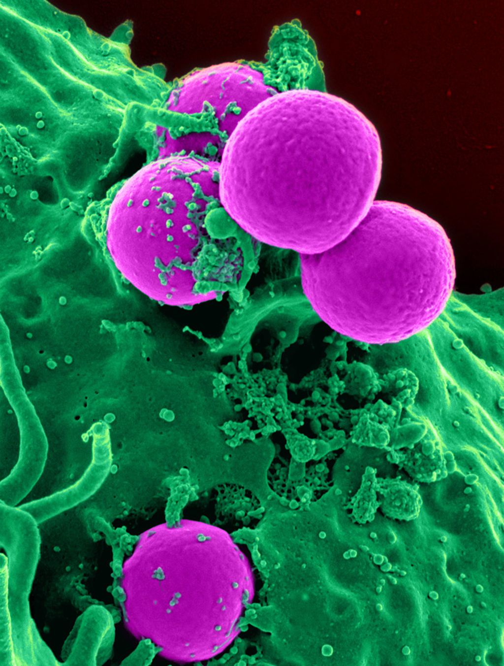 Photo caption: Agglutination of antibiotic-resistant microbial clusters
