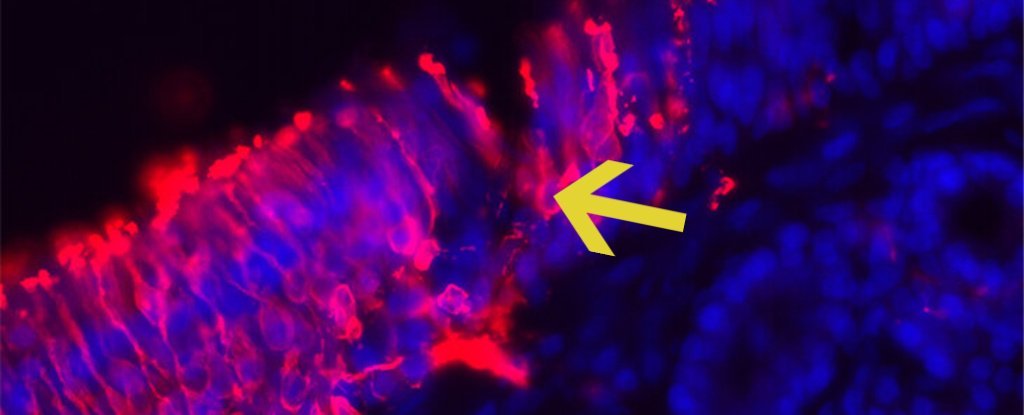 اكتشاف خلايا عصبية جديدة تنمو في أنوفنا - وجد الباحثون أن أنوفنا موطن لمزارع الخلايا العصبية المزدهرة - تكوين خلايا عصبية جديدة عندما نصبح بالغين