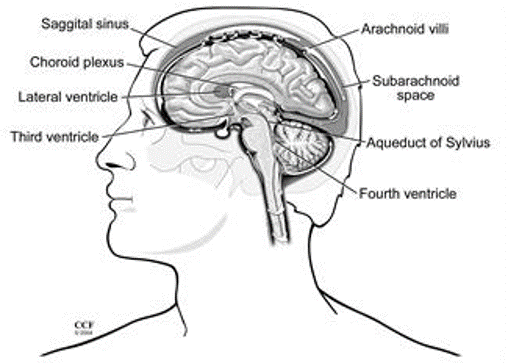 استسقاء الرأس سوي الضغط (NPH): الأسباب والأعراض والتشخيص والعلاج - حالة ناتجة عن تراكم غير طبيعي للسائل الدماغي الشوكي في تجاويف الدماغ