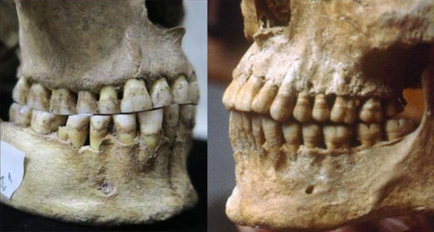 توضح الصورة الفرق بين جمجمة أنثى رومانية من البشر الصيادين-الجامعين (على اليسار) وبين جمجمة رجل يوناني بالغ عمرها 2500 عام (على اليمين)، إذ تفتقر جمجمة الأنثى لبروز الأسنان العلوية.
