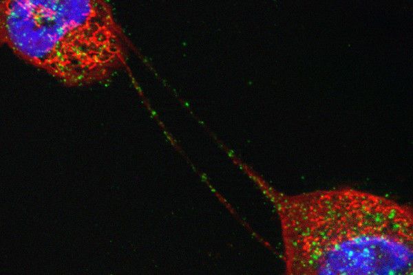 التاشير الخلوي كيف تتواصل خلايا جسمنا مع بعضها البعض مسارات التأشير الخلوي التوصل بين خلايا الجسم كيف تحدث الاستجابة المناعية ضد البكتريا والفيروسات