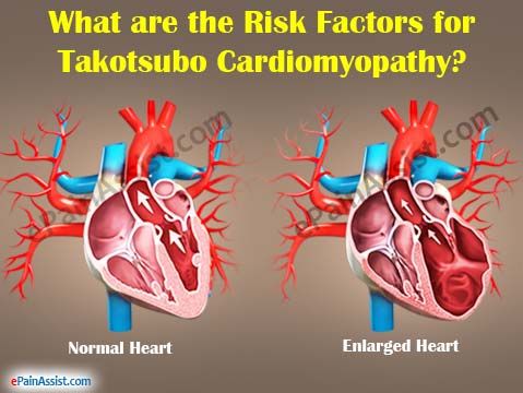 متلازمة القلب المنكسر (اعتلال العضلة القلبية لتاكوتسوبو) الأسباب والاعراض والتشخيص والعلاج ضغوطات عاطفية أو جسدية سبب قلبي وعائي 