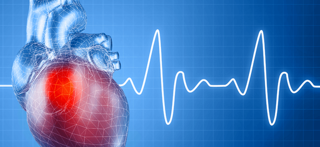 ما هو الإحصار القلبي: الأسباب والأعراض والتشخيص والعلاج إحصار الحزمة الأذينية البطينية AV bundle ضربات القلب خفقان القلب النبضات الكهربائية 