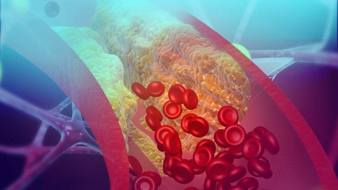 قد تساهم الدهون حول الأوعية الدموية في الحفاظ على سلامتها - الطبقة الدهنية tunica adipose - الحفاظ على صحة الأوعية الدموية