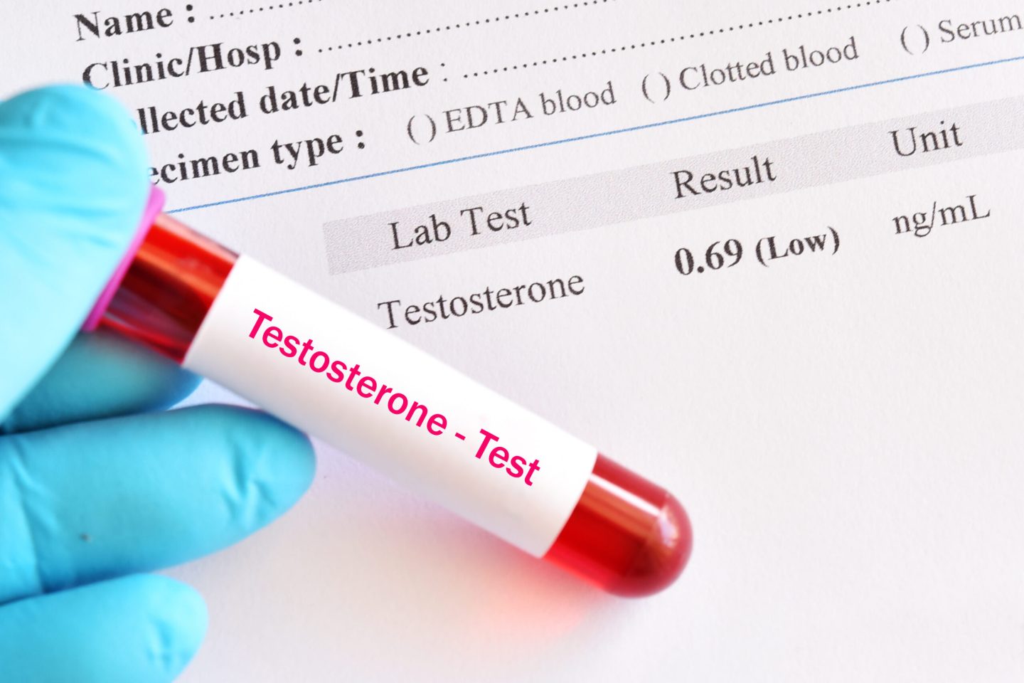 انخفاض هرمون التستوستيرون قد يؤثر في صحة القلب ويزيد من خطر الوفاة