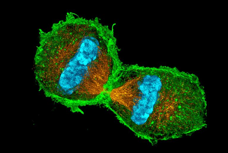 الخلية الأم هي ما يقرر انقسام الخلايا أو عدمه